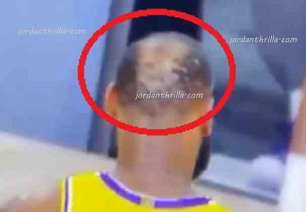 Lebron James Massive Bald Spot Goes Viral After He Destroy Clippers With Game Winning Shot