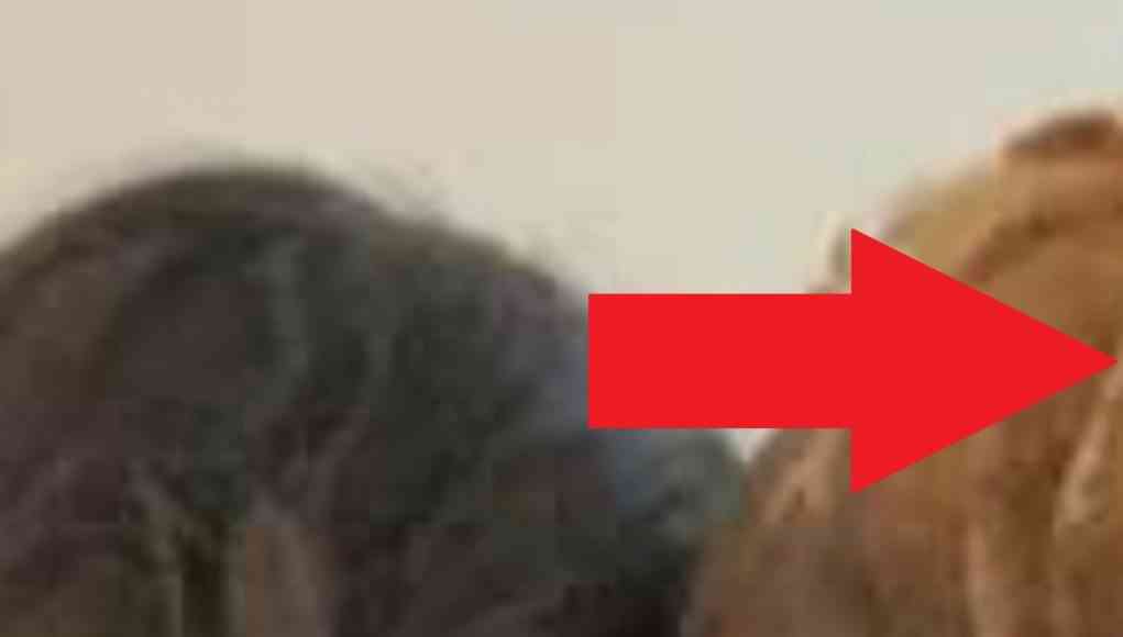 Lil Wayne S Balding Head Extreme Hair Loss And Dreads Falling Out Goes Viral Again Jordanthrilla