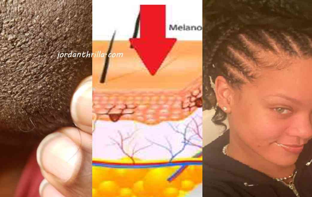 Black Man Reveals How Rihanna Fenty Skin Care Destroy His Skin Overnight