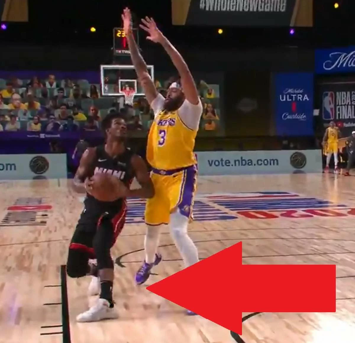 Jimmy Butler NBA Finals Injury: Jimmy Butler Injures his Leg Ankle Almost Tearing His ACL in Game 1 of 2020 NBA Finals Lakers vs Heat