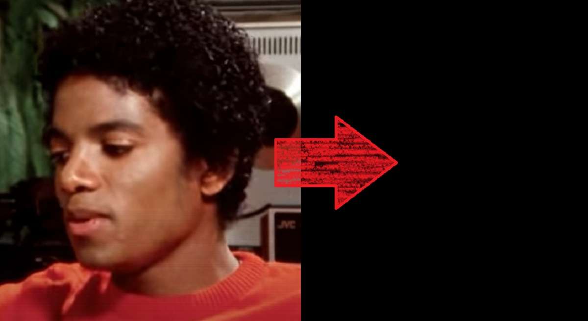 Photo Leaks of Michael Jackson with Vitiligo Spots on His Face Skin Before Alleged Skin Bleaching