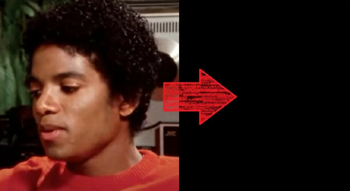 Photo Leaks of Michael Jackson with Vitiligo Spots on His Face Skin
