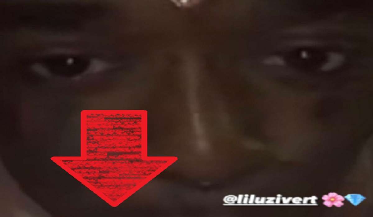 Lil Uzi Vert Gets $24 Million Rare Pink Diamond Implanted in His Forehead Like J.A.R.V.I.S. From Avengers