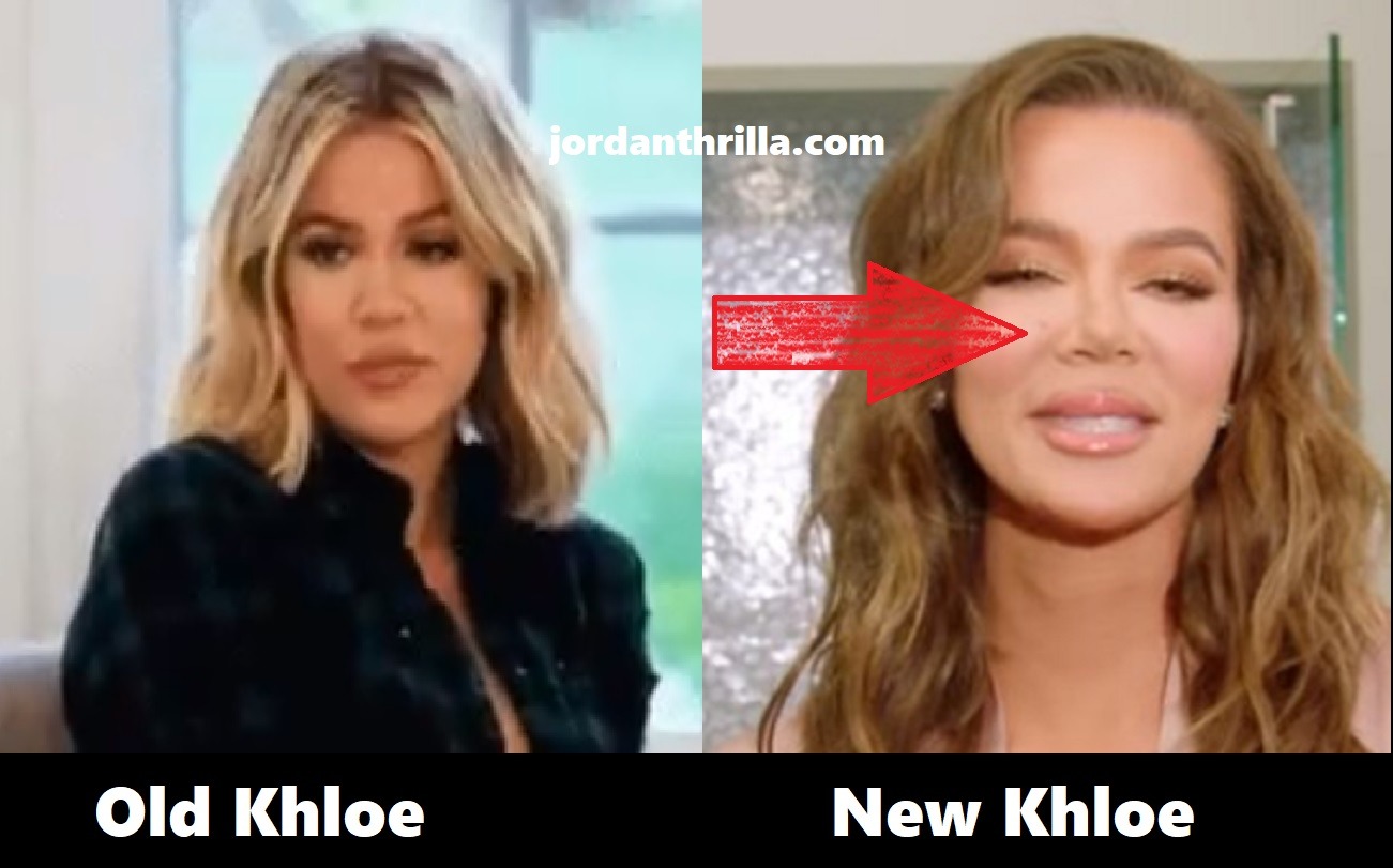 Khloe Kardashian New Face and Nose in Ipsy Video Sparks Plastic Surgery Conspiracy Theory. Khloe Kardashian before and after plastic surgery comparison