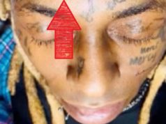 What is the Science Behind the Lil Wayne Heartbeat Tattoo of QRS Complex? Find O...