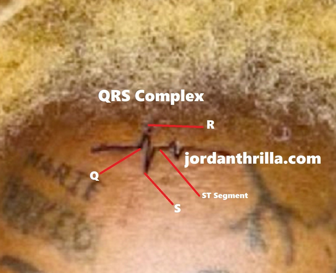 The science behind the Lil Wayne Heartbeat Tattoo of QRS Complex