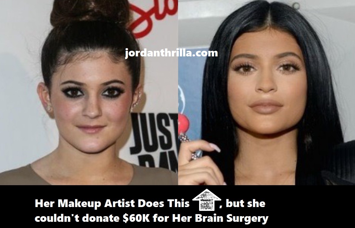 Social Media Destroys Billionaire Kylie Jenner Asking Fans to Donate $60K for Her Makeup Artist Brain Surgery after Kylie Jenner only donated $5,000