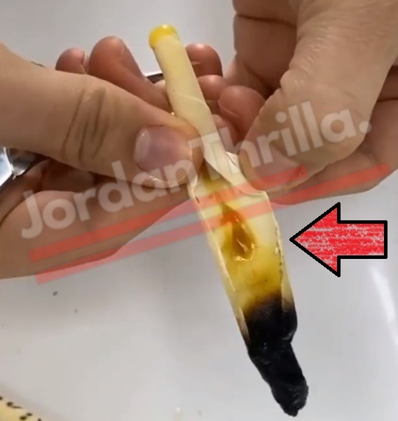 Will Sticking a Blunt in Your Ear Clean Earwax? Video of Ear Candling to Melt Ear Wax Goes Viral