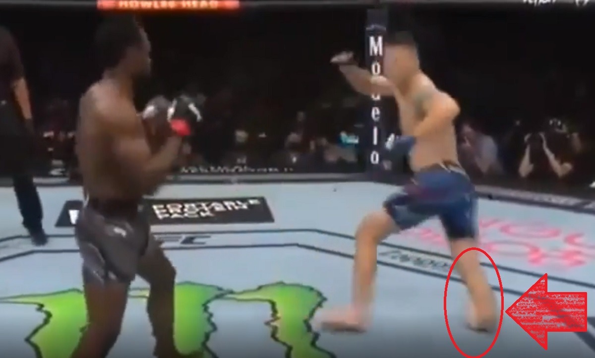 The Science Behind Why Chris Weidman Didn't Know His Leg Was Broken Before Standing On It at UFC 261