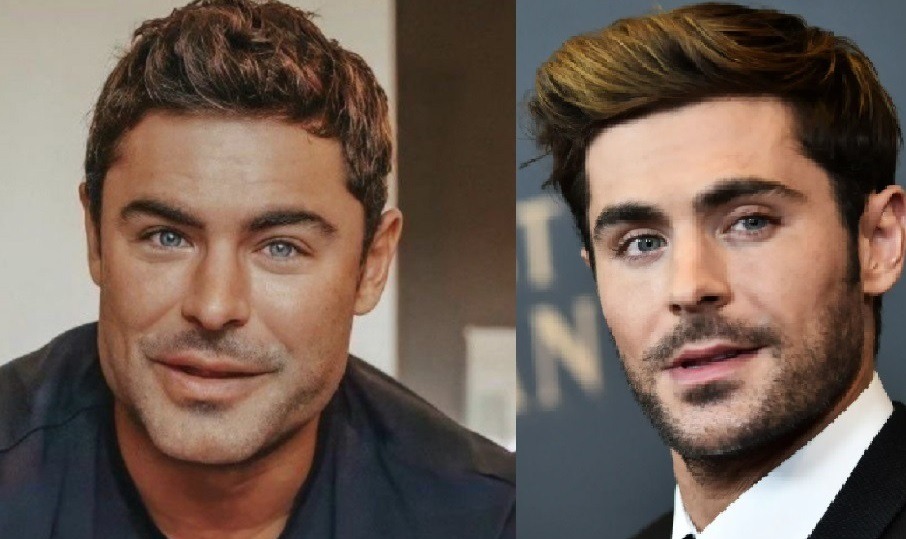 Did Zac Efron Get Jawline Plastic Surgery to Look Like Giga Chad? Fans Are Worried About Zac Efron's Plastic Surgery Jaw Look