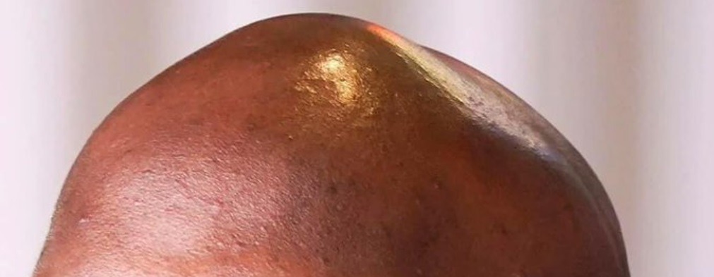 Does Young Jeezy Bald Head Look Like a Knee Cap? People on social media compare Young Jeezy head to a knee cap