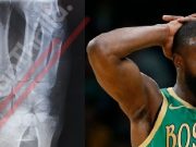 Here Is What Jaylen Brown's Torn Scapholunate Ligament In Wrist Means Long Term For His Career