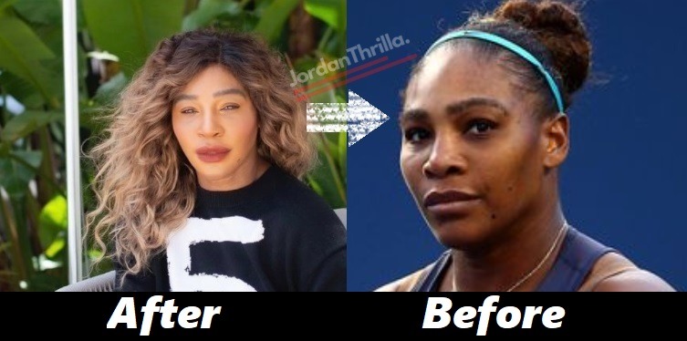 Is Serena Williams Bleaching Skin? Serena Williams Deletes Instagram Picture After Bleached Skin Accusations Go Viral. Deleted photo fueling the Serena Williams bleached skin conspiracy theories.