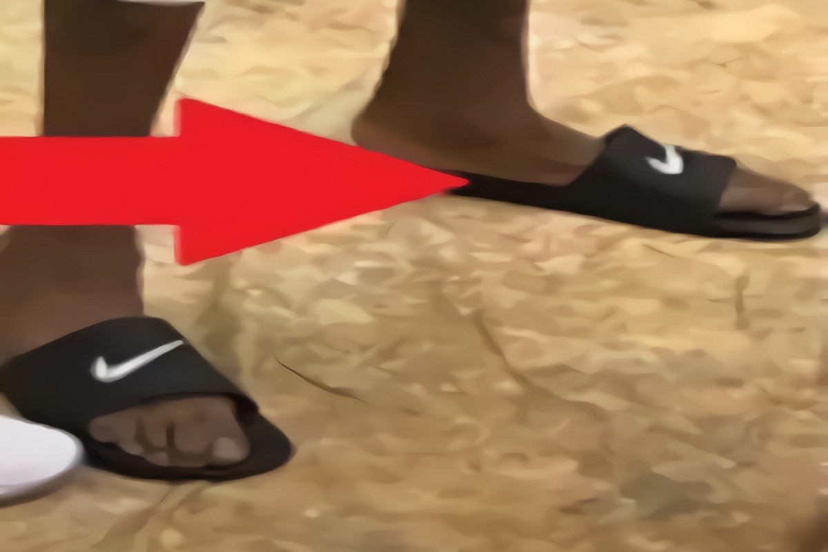Is Kevin Durant's flat deformed foot really to blame for his Achilles Tendon Rupture Injury?