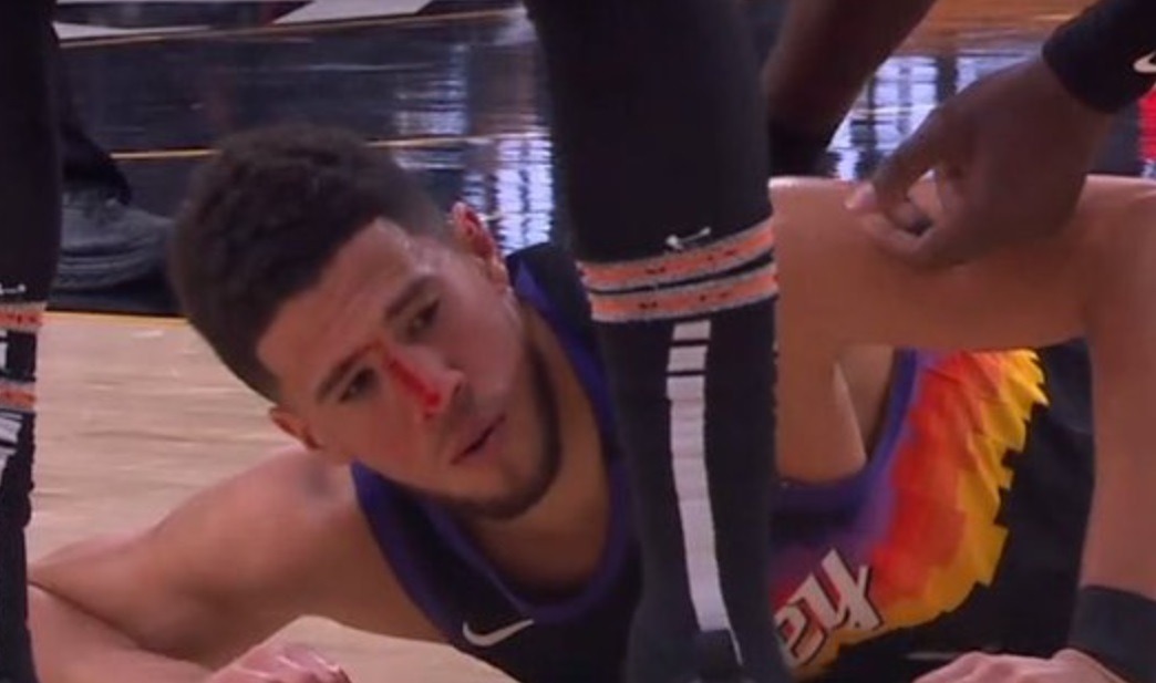 Did Patrick Beverley Intentionally Headbutt Devin Booker Head Leaving Him Bleeding and Almost Knocked Out. Devin Booker head bleeding.