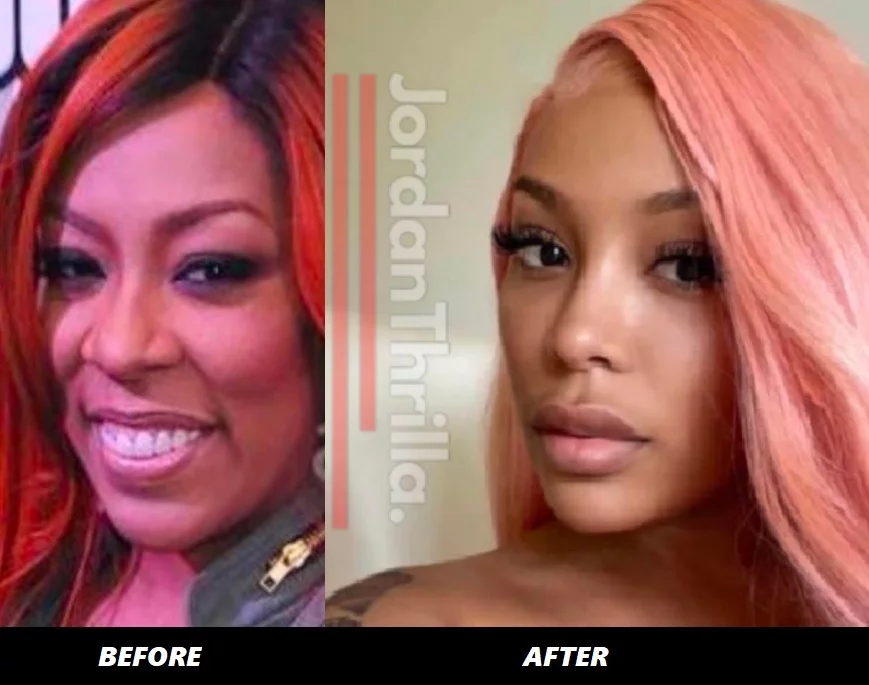 People Can't Believe K Michelle's Plastic Surgery Face in Newest Photo. K Michelle's new face