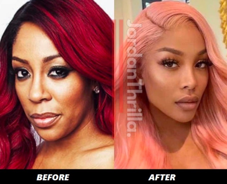 People Can't Believe K Michelle's Plastic Surgery Face in Newest Photo. K Michelle's new face