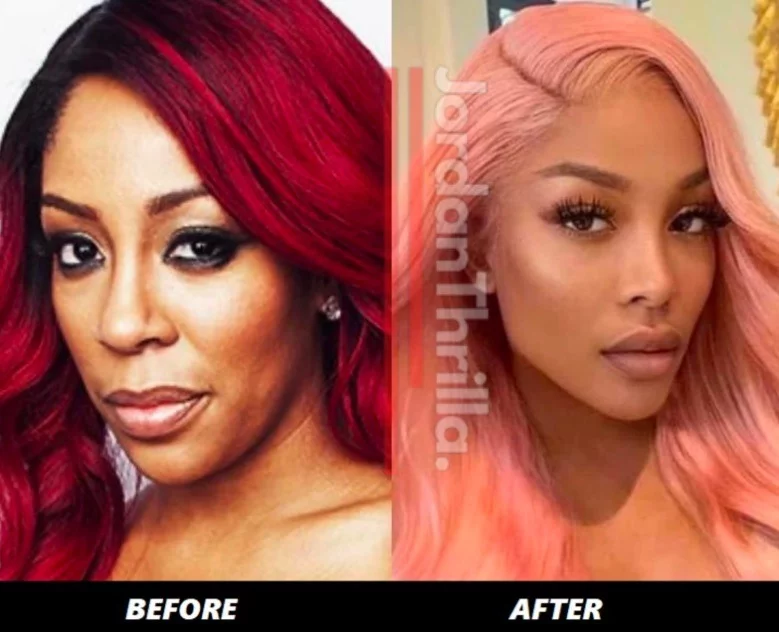 People Can't Believe K Michelle's Plastic Surgery Face in Newest Photo. K Michelle's new face