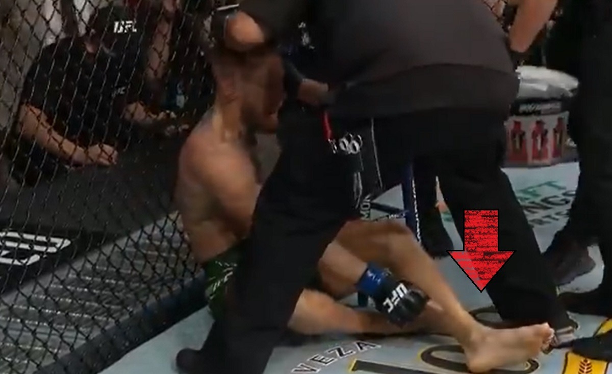 Did Conor McGregor Break His Ankle and Leg Checking a Kick From Dustin Poirier?
