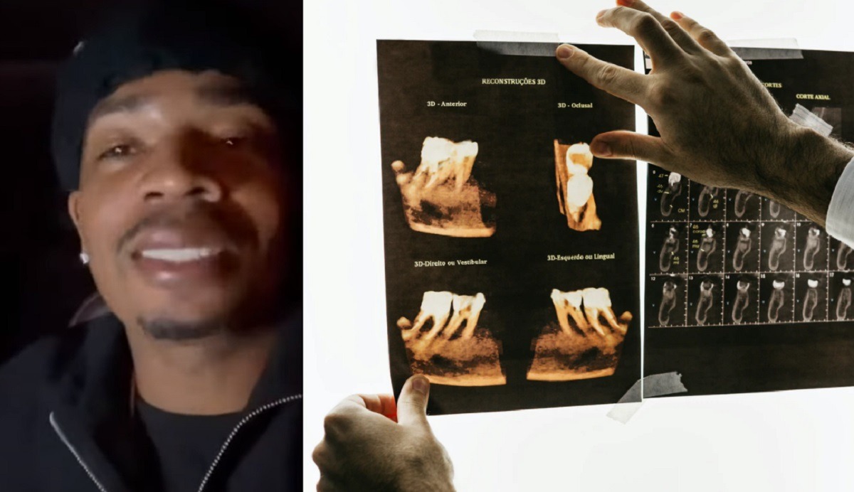 Are These Plies Rotten Teeth In Dentist Photo?