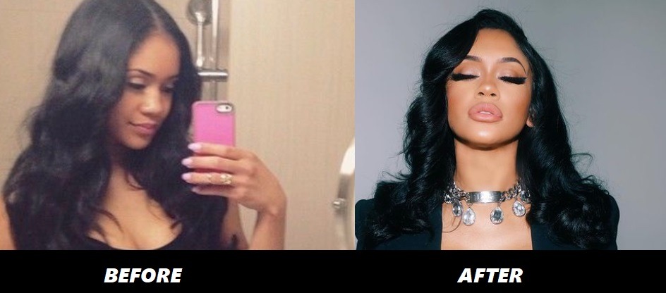 Saweetie Before Plastic Surgery compared to after.