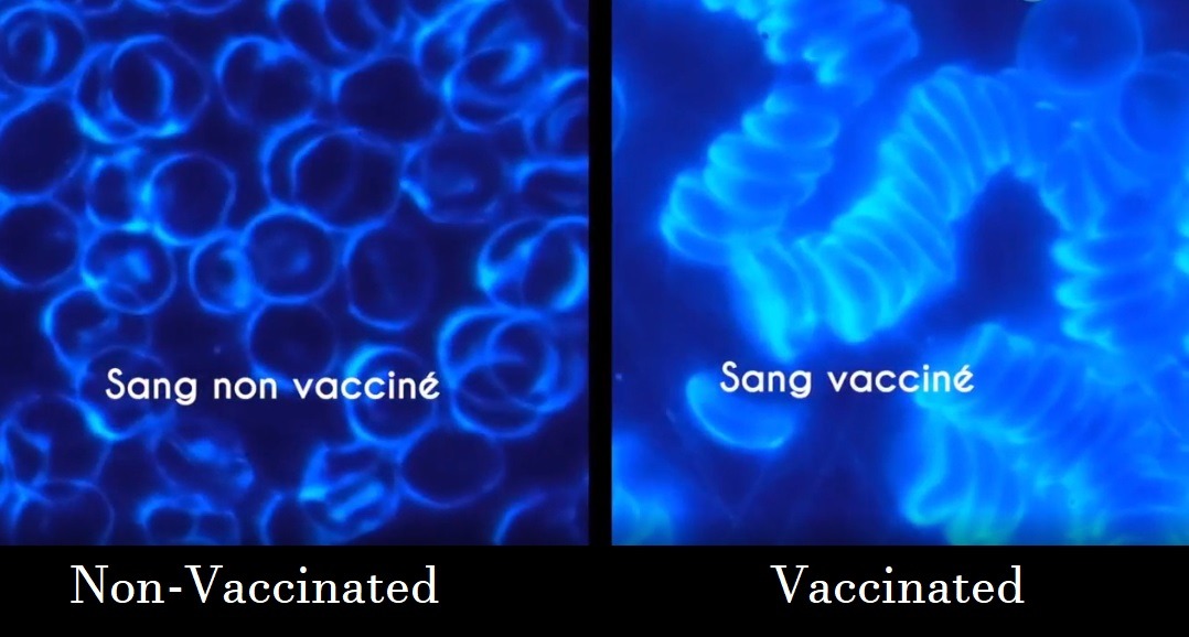 Toxicology Doctor Armin Koroknay Comparing Non-Vaccinated Blood to Vaccinated Blood After Getting COVID-19 Vaccine Goes Viral