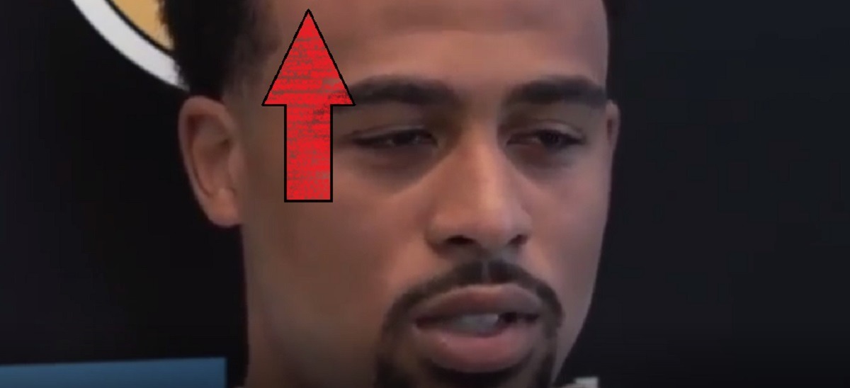 Talen Horton-Tucker Balding Receding Hairline Goes Viral After Press Conference Reacting to Signing 3 Year Contract with Lakers