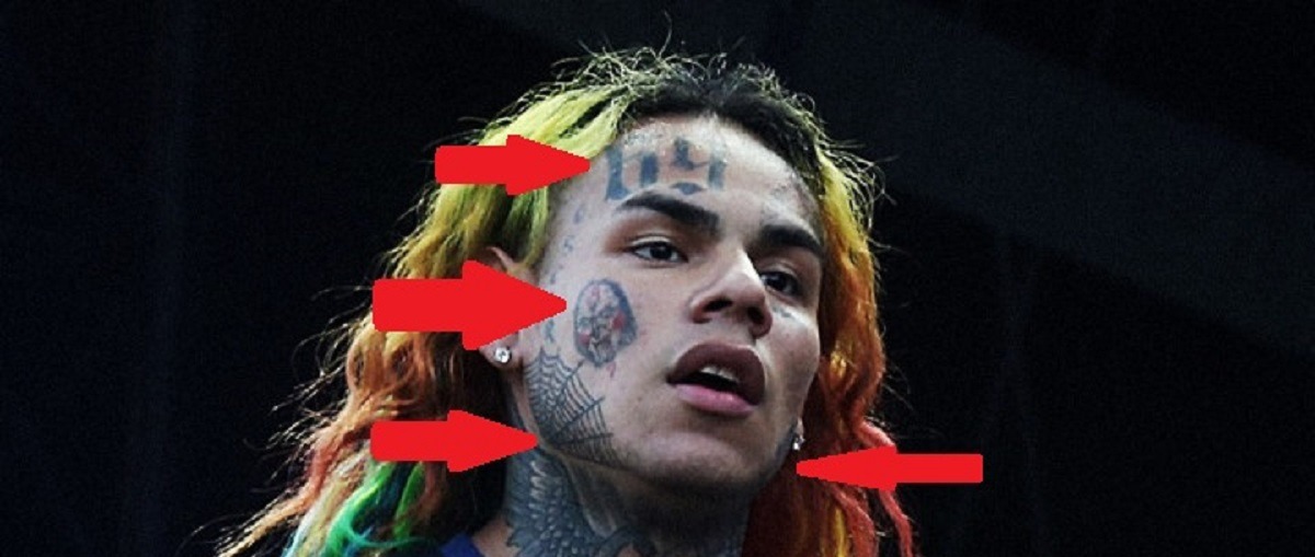 US Government to PAY for Tekashi 6IX9INE to remove Face tattoos as part of Witness Protection Deal????