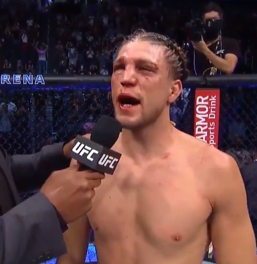 Video of Brian Ortega Rushed to Hospital after UFC 266. Video Shows Brian Ortega in Ambulance in Pain After Losing to Alexander Volkanovski at UFC 266. Brian Ortega face at UFC 266.
