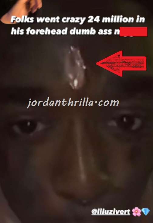 Why Did Fans Rip Out Forehead Diamond on Lil Uzi Vert Face at Rolling Loud? Fans ripped out Lil Uzi Vert forehead diamond at Rolling Loud