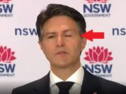 Is Australian Minister Victor Dominello's Droopy Eye Bell's Palsy a COVID-19 Vaccine Side Effect?
