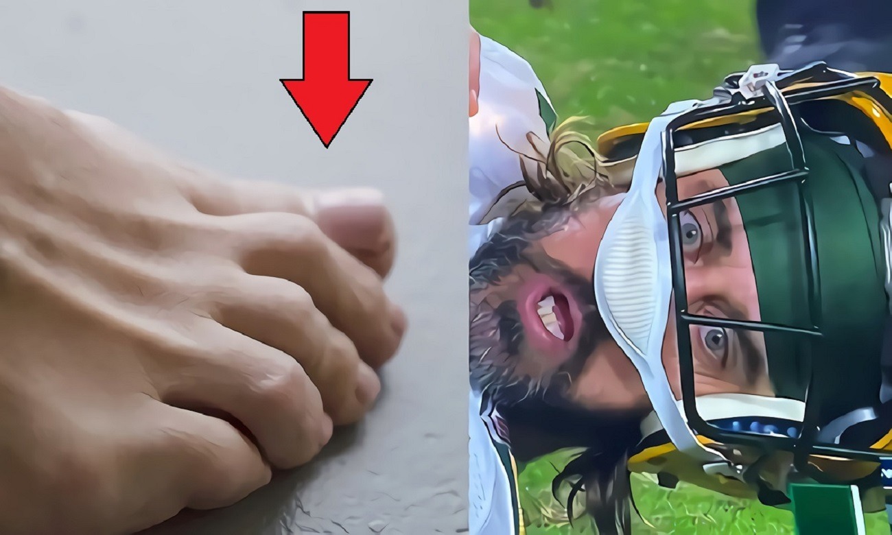 Does Aaron Rodgers Have COVID-19 Toe? Aaron Rodgers Shows Toe Evidence Debunking Wall Street Journal COVID Toe Story. How Did the Rumor Aaron Rodgers has COVID Toe Start? Aaron Rodgers exposes Wall Street Journal fake COVID toe story. Does Aaron Rodgers have COVID toe answer. Aaron Rodgers showing his toe to the camera.