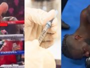 Details on the Tyson Fury Elbow Steroid Cheating Scandal: Did Tyson Fury Cheat By Using Steroid Injections Before Trilogy Fight with Deontay Wilder?