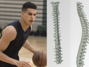 Michael Malone Reveals Scary Update About Michael Porter Jr's Mystery Back Injury and How Long He Might be Out