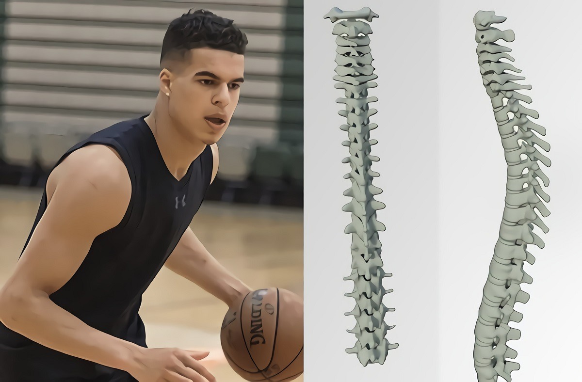 Michael Malone Reveals Scary Update About Michael Porter Jr's Mystery Back Injury and How Long He Might be Out