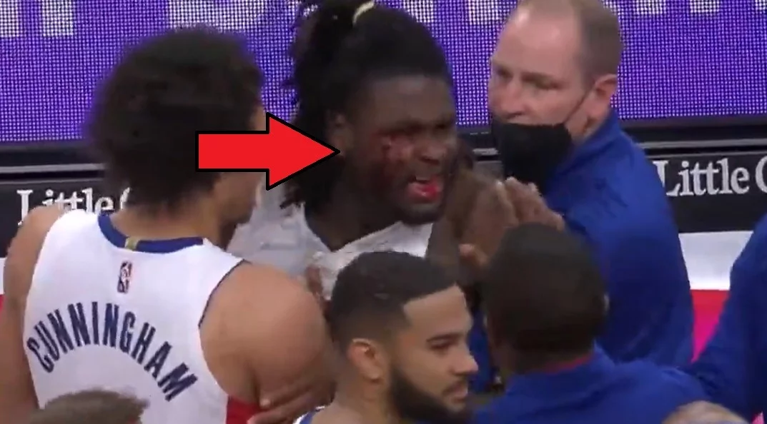 Did Lebron Dirty Elbow Isaiah Stewart Bloody? Isaiah Stewart Tries to Fight Lebron James Before Ejection. Lebron James elbowing Isaiah Stewart in the face. Did Lebron James Dirty Elbow Isaiah Stewart Leaving Him Bleeding? Lebron James ejected Lakers vs Pistons. Isaiah Stewart fighting Lebron James.