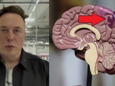 Elon Musk Reveals When Neuralink Brain Chip Implants Will Be Implanted in Human ...