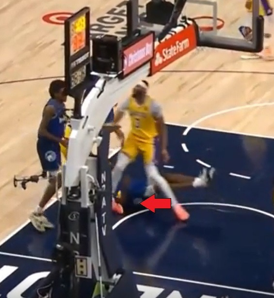 Did Anthony Davis Break His Ankle? 'Damn AD' Trends after Anthony Davis Serious Ankle Injury Accident. Here is a picture of the moment some people think Anthony Davis broke his ankle