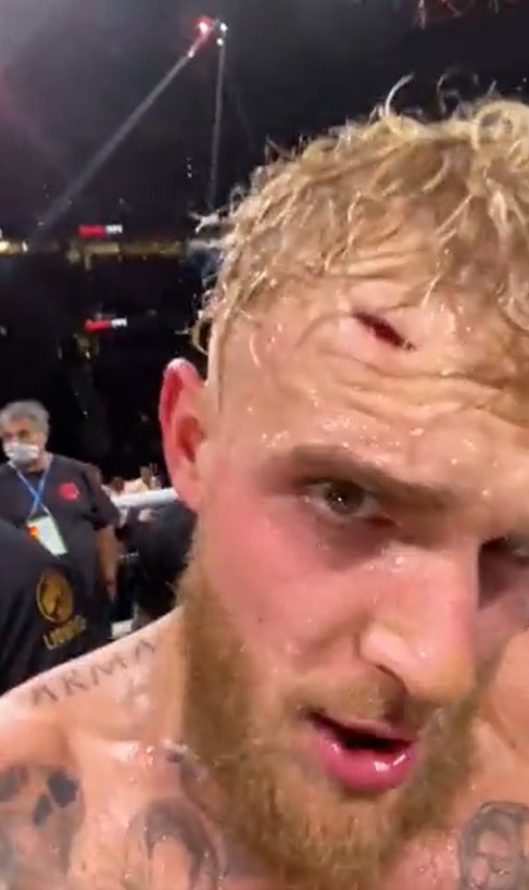 Did Tyron Woodley Dirty Elbow Jake Paul Leaving Him Bloody During Boxing Rematch? Referee's Comments Leave People Confused. Why Did Referee Say Tyron Woodley Elbowed Jake Paul Leaving Him Bloody During Boxing Rematch? Jake Paul bleeding from his head after Tyron Woodley elbow.