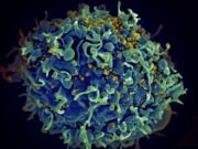 Did Moderna HIV Vaccine Make HIV Mutate? HIV VB Variant in Netherlands Sparks Moderna HIV Vaccine Conspiracy Theory