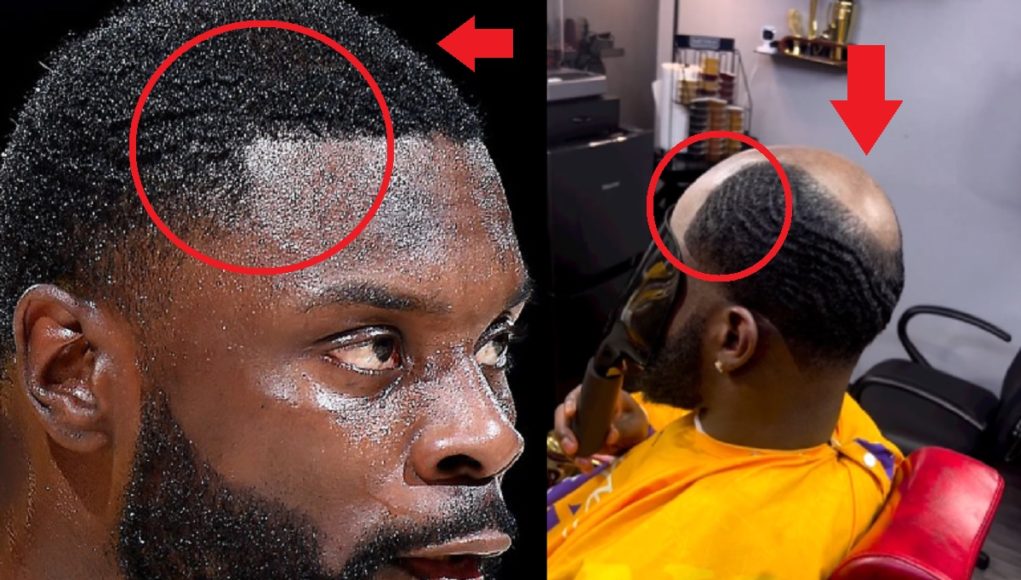 Lance-Stephenson-Hairline-Movement-Details