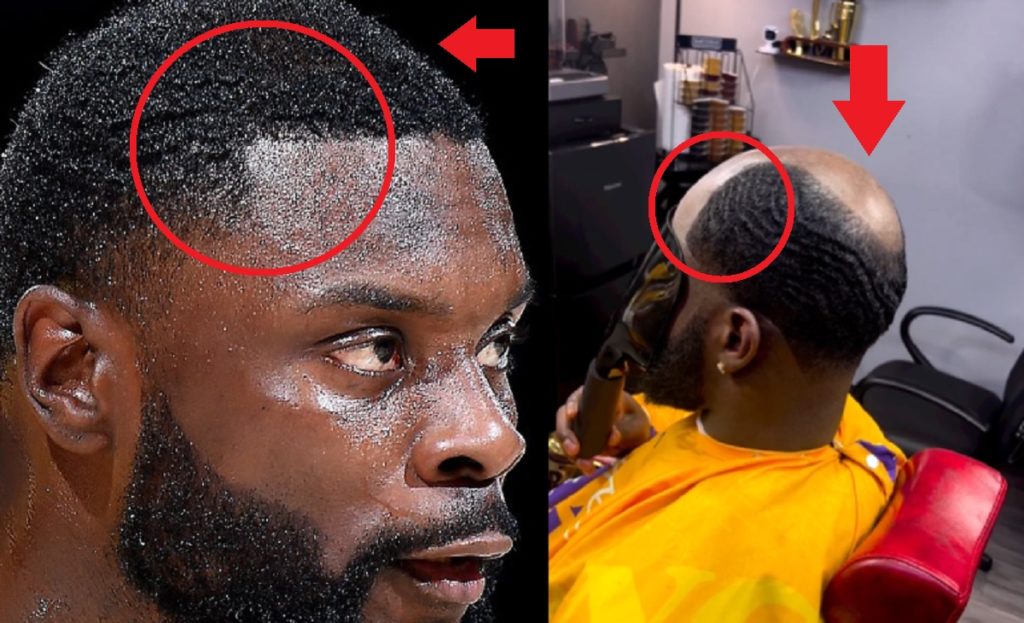 Details on How the Lance Stephenson Hairline Movement is Changing the Future of Hair loss for black men. Also evidence of Lance Stephenson's fake hair.