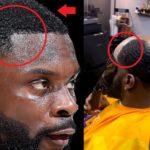 Does Lance Stephenson Have Fake Hair? A Lance Stephenson Hairline Movement is Changing the Future of Hair loss