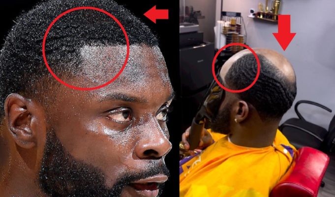 Does Lance Stephenson Have Fake Hair? A Lance Stephenson Hairline Movement is Changing the Future of Hair loss