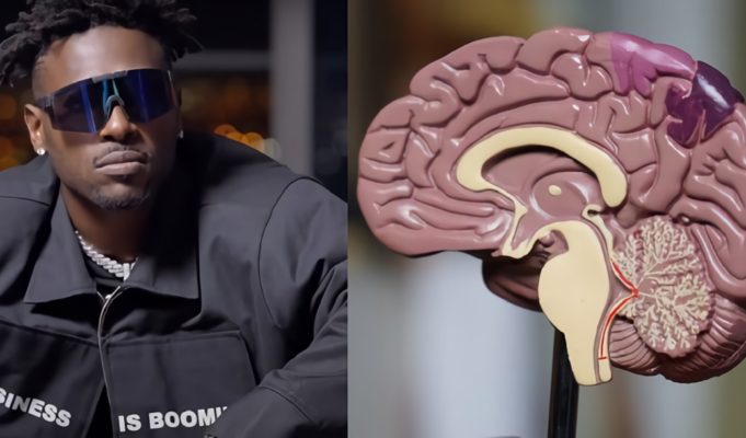 Antonio Brown Admits Having CTE on IG Live and Blames James Harrison's Alleged Illegal Helmet Hit