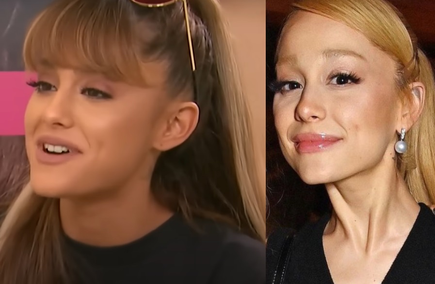 Ariana Grande Skin bleaching conspiracy.