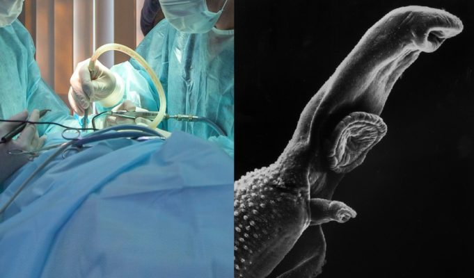 Are Australian Brain Worms the Next Major Zoonotic Threat to Human Kind?