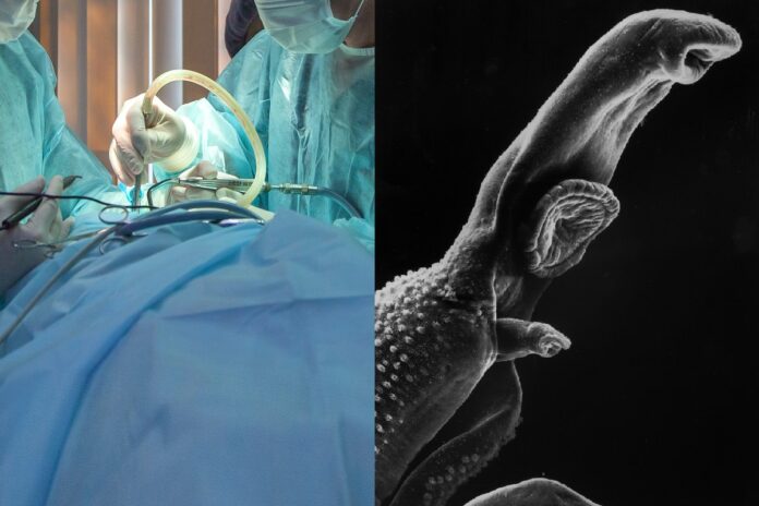 australian-brain-worm-zoonotic-threat-theory