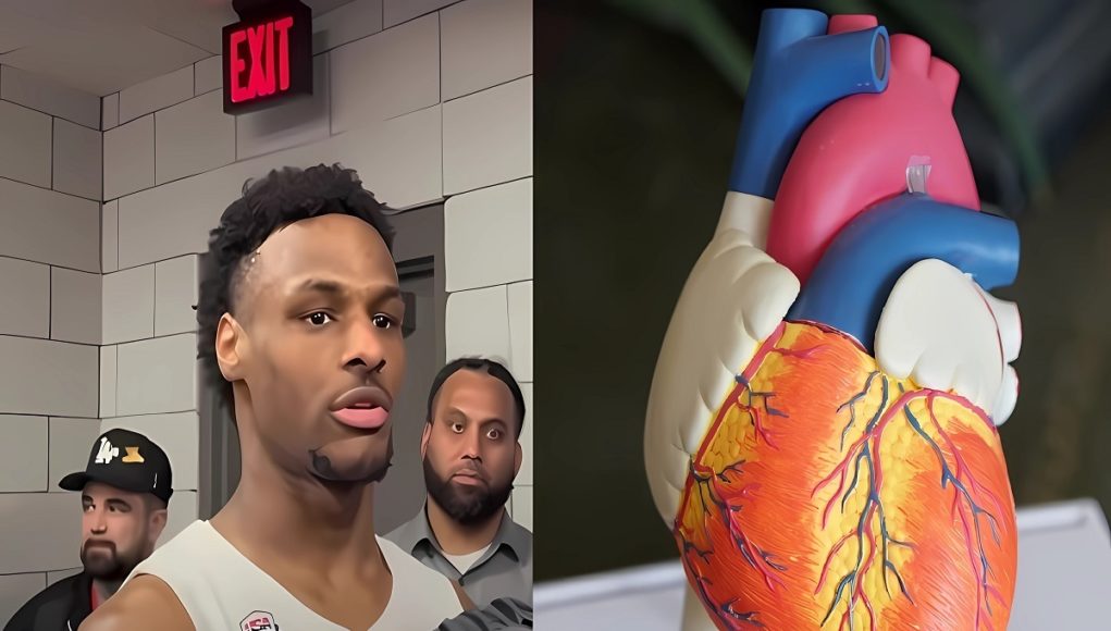 bronny-james-heart-defect-surgery-rumor