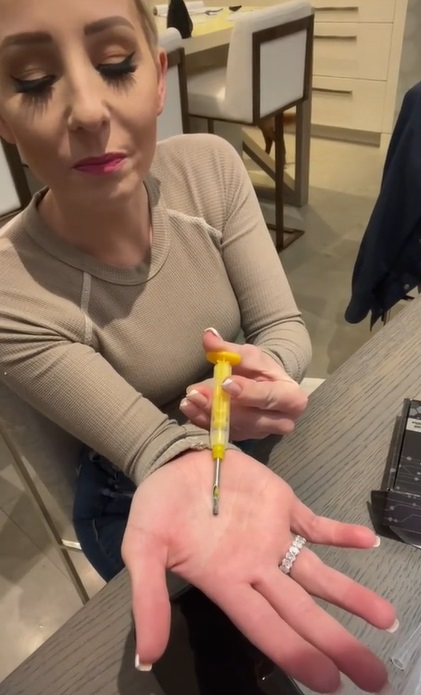 Burgundy Waller aka 'Chip Girl' Showing How Chip Was Implanted in Her Hand to Buy Groceries at Whole Foods